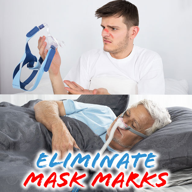 How to Remove CPAP Face Marks // Guide 